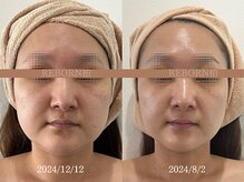リボーン 柏(REBORN)の雰囲気（見た目年齢の崩壊、始まる。今すぐ【再生美容】秋老け加速中です）