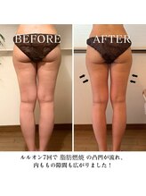 ヨサパーク リバティ 池袋東口店(YOSA PARK Liberty)/Before＆After