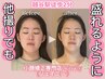 【お着替えなしで速攻小顔に！！】小顔矯正＋小顔オイルリンパ通常¥15,400→