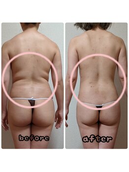 リセル(Re-Cell)の写真/新年スタートダッシュ!!全身脂肪撃退！本気デトックス★溜め込んだ内臓脂肪も落ちにくい贅肉も徹底燃焼!!