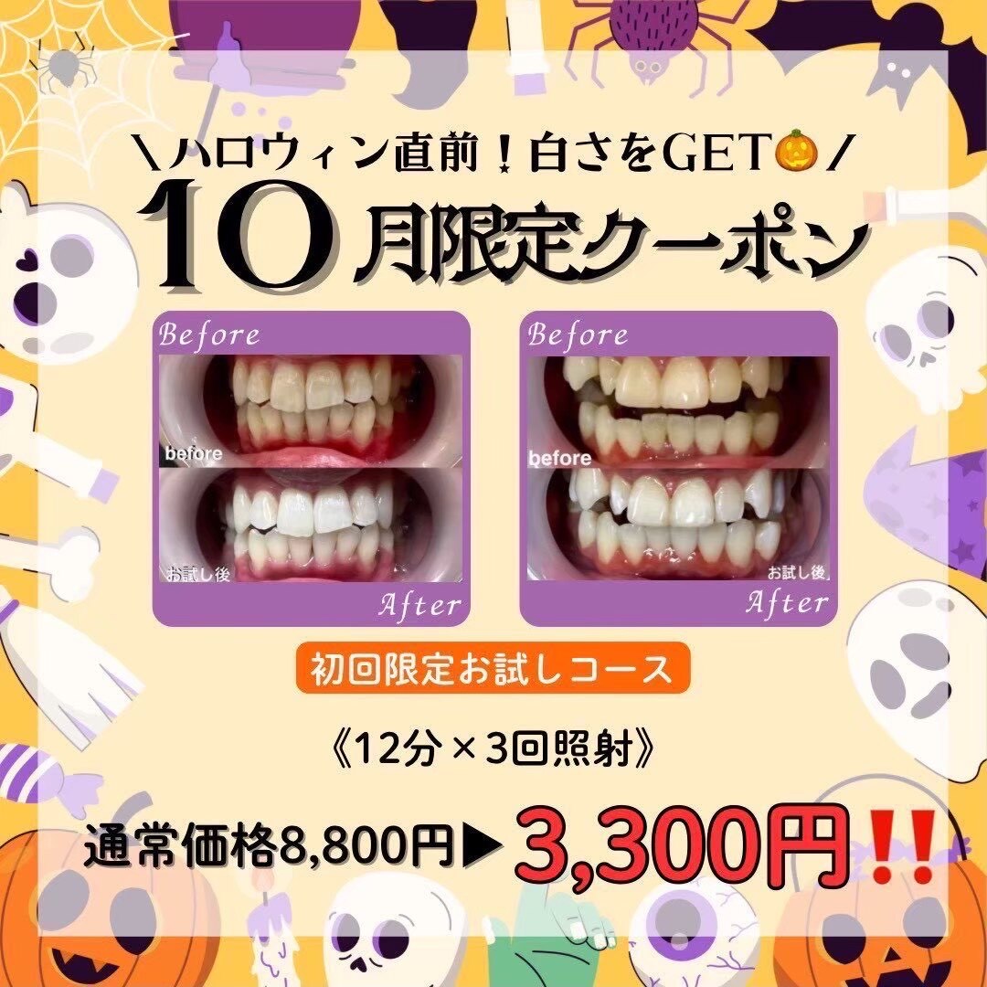 10月限定【お試し価格！】ホワイトニング12分×3回照射 ￥8,800→￥3,300