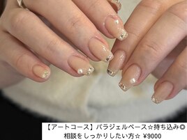 ストーンフレンチ#パラジェル