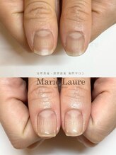 マリーロール 梅田店(Marie Laure)/深爪矯正/自爪育成/自爪風