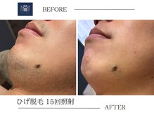 メンズメイド(Mens'Made)/before /after