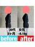 【産後６ヶ月以降の方】産後ダイエットコース初回カウンセリング&体験施術