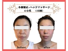 ビュートの雰囲気（お顔の変化をしっかりご確認ください【垂水　小顔】）