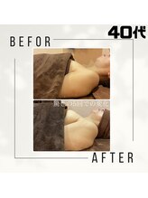 美 ワン(美 one)/プリンセスバスト