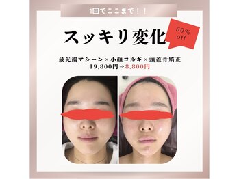 サロン叶(kanau)/人気No.1。頭から小顔に