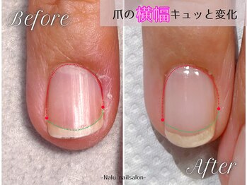 ナル(Nalu.)/横幅狭くみせるとスラッと爪に◎