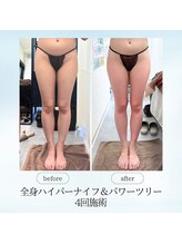 エスプレッソ(espresso,)/【下半身4回】隙間広がりました!