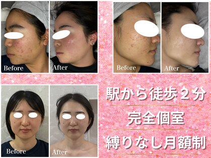 ノア 新宿(Noa)の写真