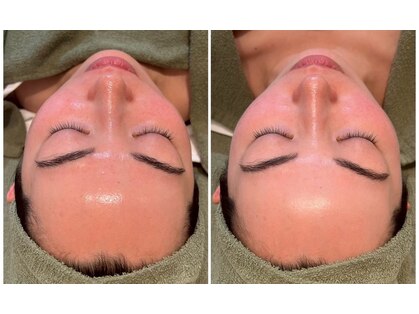 ミラ 中央林間(mira)の写真