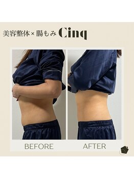 サンク(Cinq)/腸もみと整体と痩身にて体の歪み