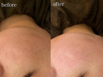 テオリア(TEORIA)/