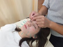 さくら鍼灸整骨院の雰囲気（継続的に通って頂きたいのでリーズナブルな価格美容鍼￥3000　）