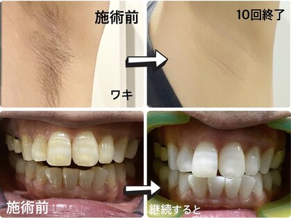 ワイズサロン(Y's salon)の写真