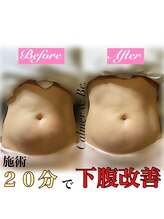 カルマーアンドビー(Calmer & Be.)/【レディース痩身】Before/After