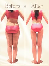 ピュアエステ ブリアント 新宿店&nbsp;30代 痩身結果