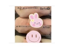スターリィ スカイ(Starry☆Sky)/before→after
