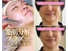 【人気No2!脂肪分解/たるみ/クマ】進化版レモンボトル×即効小顔フェイシャル