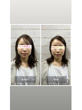 カラダプラス(kArAdA+)/小顔矯正ビフォーアフター女性