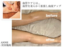 アンネ ビューティー クリニーク(ANNE BEAUTY CLINIQUE)の雰囲気（プライベートサロン完成予約制/血流改善/毛穴ケア/小顔/リンパ）