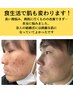 【健康になりたい方限定】食事アドバイス×根本整体コース約120分　¥4,980 