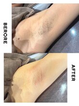 KANコルギセラピー 群馬渋川店/WAX脱毛