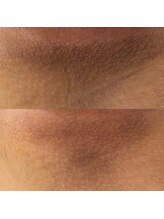 リ クリニカル ラボ(Re clinical Labo)/ローマピンクBody