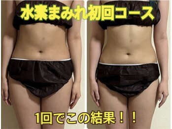 ヨサパーク モア(YOSAPARK MORE)