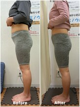 御幸橋あさひ整骨院/産後の骨盤矯正