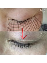 スプーンプラス アイラッシュ(spoon+eyelash)/ラッシュアディクトサロンケア　