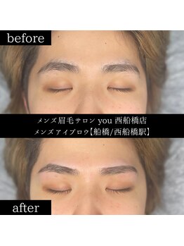 ユー 西船橋店(you)/ビフォーアフター写真