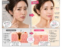 ソワ 吉塚店(soi)