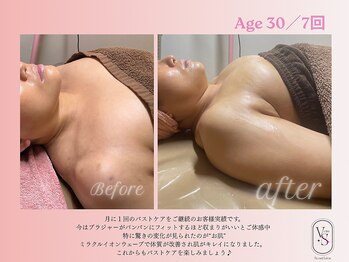 ヴィーナス(Venus)の写真/神業ハンド技術で左右対称×バストアップ☆20代～60代まで幅広い年齢悩みも多数解消してきた実力派サロン♪