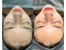 ビーオール 表参道店(B:ALL)/Before→After