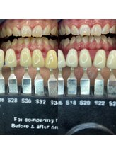 トウキョウスワーズ 池袋店(TOKYO SWRS)/#ホワイトニング #池袋 #渋谷