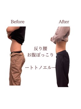 整体院トトノエル 西川原院/Before→After
