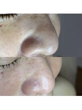 シャイニー(SHINY)/60代女性