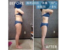 ヴィオテラス(VIOTERACE)の雰囲気（熟練のオールハンドの揉み出しリンパマッサージでセル脂肪撃退！）