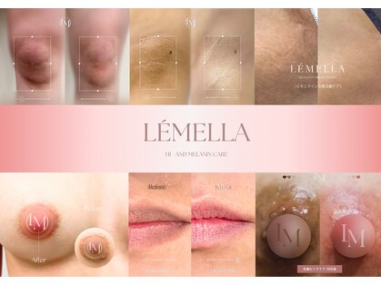 ピュアソル(Puresol)の写真