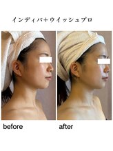 ウィッシュプロサロンケー(WISHpro salon K)/インディバ×ウイッシュプロ