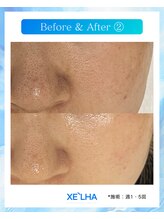 サロンエヌ(salon N)/韓国人気NO.1セラピール