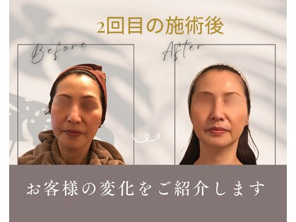 オトゥールボーテ(OToolBeaute)の写真