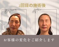 オトゥールボーテ(OToolBeaute)