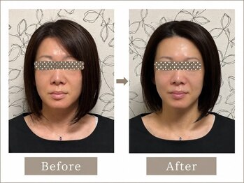 プレシャス(Precious)の写真/鏡を見るのがもっと楽しくなる♪しみ・しわをケアして、5年後も自信が持てる透明美肌へ。