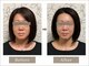 プレシャス(Precious)の写真/鏡を見るのがもっと楽しくなる♪しみ・しわをケアして、5年後も自信が持てる透明美肌へ。