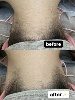 リル(Lil)/うなじもスッキリ☆