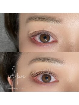 エクリプス(ECLIPSE)/似合わせパーマ