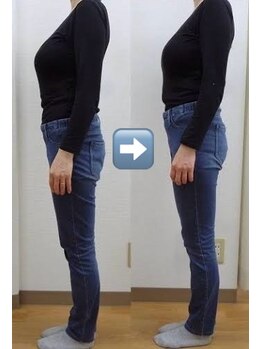 カイロプラクティック ネクサス/産後の骨盤の歪み撃退☆